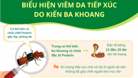 Biểu hiện viêm da tiếp xúc do kiến ba khoang