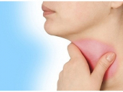 Bị viêm họng bao lâu thì khỏi, cách điều trị hiệu quả...