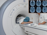 Chi phí chụp cộng hưởng từ MRI giá bao nhiêu tiền?