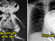 19 bức ảnh chụp X-quang kỳ quặc nhất trần đời, nhìn số 7 mới hiểu nỗi khổ của con gái
