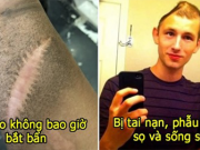 21 hình ảnh kỳ quặc ngẫu nhiên khiến bạn giật mình, thứ bệnh lạ khiến da không bao giờ có nếp nhăn