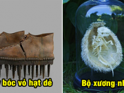 18 hình ảnh hiếm sẽ giúp bạn mở mang tầm mắt, bộ xương nhím trông thật kỳ dị