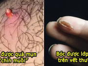 16 việc vừa bẩn vừa ghê nhưng lại 'sướng tê người', ai cũng đã từng làm