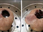 Bài thuốc chữa đau khớp và gút cực kỳ hiệu nghiệm từ những thứ rất đơn giản