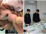 Bị bọ ve cắn, 2 người trong gia đình không qua khỏi, 1 người cấp cứu: Cảnh báo nhà nuôi chó mèo phải cẩn thận