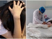 2 dấu hiệu cơn đột quỵ sắp ập tới ai cũng phải biết để vào viện ngay: Cô gái 22 tuổi chủ quan suýt qua đời