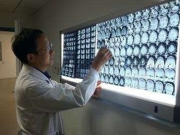 Hình chụp X-quang rợn người của cô gái bị nhiễm sán