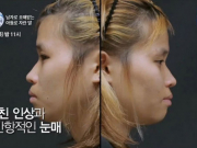 Xấu xí lại bị tấn công tình dục, cô gái Hàn thay đổi cuộc đời nhờ PTTM