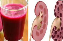 3 thức uống trời ban giúp hồi sinh 2 quả thận chỉ trong 24 giờ