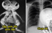 19 bức ảnh chụp X-quang kỳ quặc nhất trần đời, nhìn số 7 mới hiểu nỗi khổ của con gái