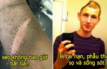 21 hình ảnh kỳ quặc ngẫu nhiên khiến bạn giật mình, thứ bệnh lạ khiến da không bao giờ có nếp nhăn