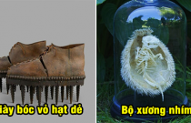 18 hình ảnh hiếm sẽ giúp bạn mở mang tầm mắt, bộ xương nhím trông thật kỳ dị