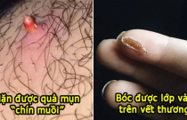 16 việc vừa bẩn vừa ghê nhưng lại 'sướng tê người', ai cũng đã từng làm