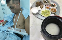Chồng vị vợ đánh nhập viện, khâu 6 mũi chỉ vì nấu cơm quên không nhấn nút