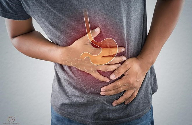 Có thể bạn chưa biết: 4 biến chứng thường gặp của viêm loét dạ dày
