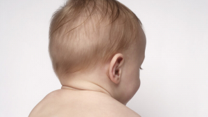 Trẻ sơ sinh rụng tóc: Nguyên nhân và cách can thiệp