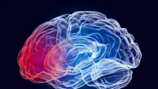 Hy vọng mới trong điều trị Parkinson với liệu pháp tế bào gốc chỉnh sửa gene