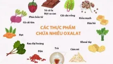 Bảo vệ thận khỏi sỏi thận bằng thói quen sinh hoạt lành mạnh