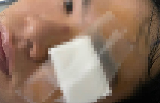 Công an mời thanh niên nghi bị CSGT dùng gậy “tác động” lên làm việc
