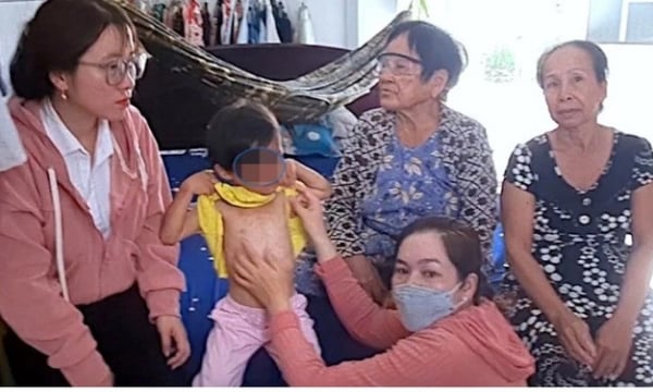 Giải cứu cháu bé có dấu hiệu bị bạo hành tại Cà Mau