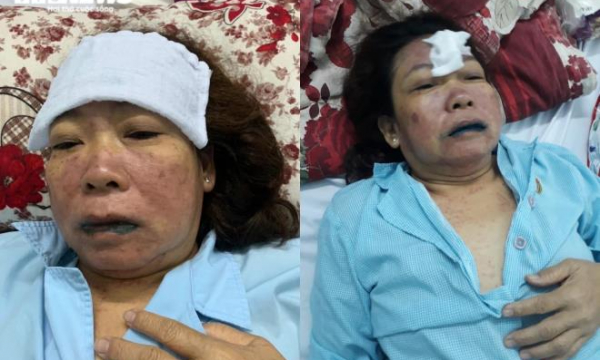 Uống thuốc do bác sĩ Bệnh viện Sài Gòn ITO kê, người phụ nữ suýt mất mạng