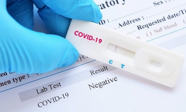 Vụ công nhân Indonesia nghi nhiễm Covid-19: Bệnh viện FV nhận mẫu xét nghiệm sai quy trình?