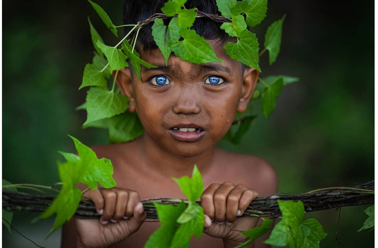 Hội chứng hiếm gặp khiến nhãn cầu mắt trở nên xanh sáng ở một bộ tộc tại Indonesia