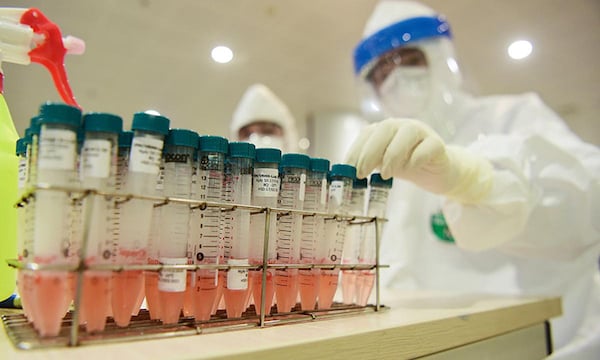 TP Hồ Chí Minh: Chuyên gia người Hàn Quốc xét nghiệm PCR âm tính với SARS-CoV-2