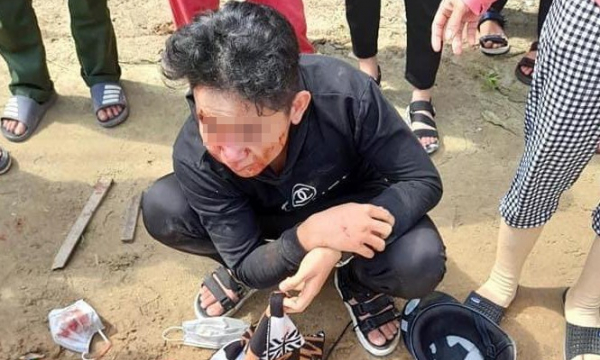 Quảng Bình: Trên đường đi học về, học sinh bị đánh bất tỉnh