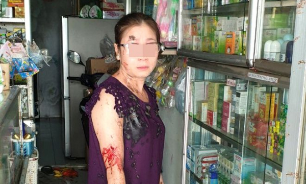 TP.HCM: Chủ tiệm thuốc tây trình báo việc liên tiếp bị tạt mắm tôm 'khủng bố'