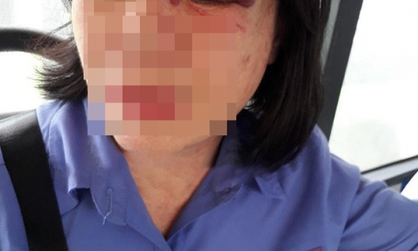 Nữ tiếp viên xe buýt ở Sài Gòn bị hành khách đánh sưng mắt