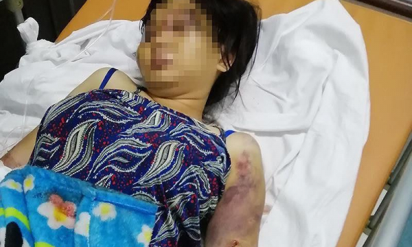 Truy tố 3 người tra tấn cô gái đến sẩy thai ở Bình Chánh