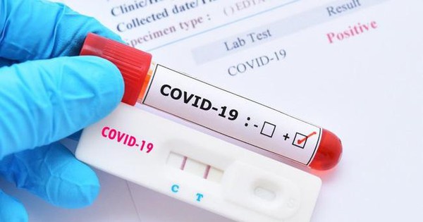 Sở Y tế TPHCM có trách nhiệm phân bổ kit test nhanh COVID-19 cho các trường học