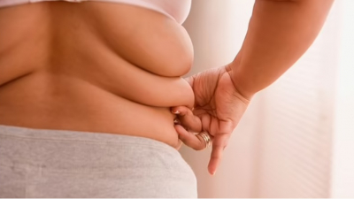 Phụ nữ béo phì có nguy cơ bị gãy xương cao 40%