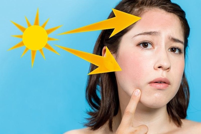 Những cách đơn giản giúp bảo vệ làn da khỏi nắng nóng mùa hè