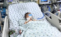 Cảnh báo diễn tiến nhanh và nguy hiểm của bệnh tay chân miệng ở trẻ dưới 2 tuổi