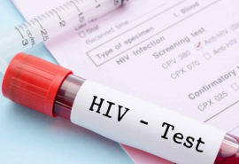 Lợi ích của việc xét nghiệm HIV sớm