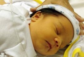 Vàng da ở trẻ sơ sinh – Những điều cần biết