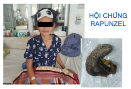 Đắk Lắk: Phẫu thuật cấp cứu thành công cho bệnh nhi mắc hội chứng Rapunzel