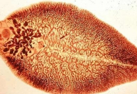 Nhận biết và phòng chống bệnh sán lá gan nhỏ: Clonorchiasis