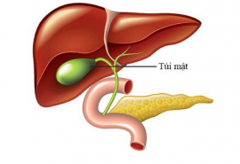 Những điều cần biết về bệnh Polyp túi mật