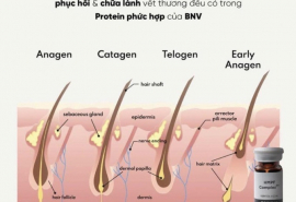 Công nghệ MPF - điều trị rụng tóc chuyên sâu từ gốc rễ