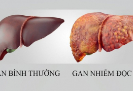 Cách phòng bệnh nhiễm độc gan