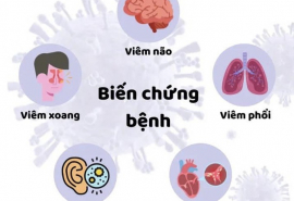 Các biến chứng của bệnh cúm