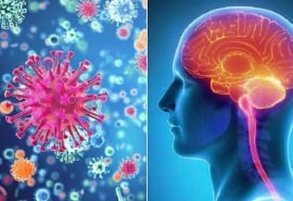 Khuyến cáo phòng bệnh viêm não, màng não do não mô cầu