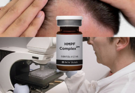 Phát hiện phức hợp tiên phong G4PRF-300™ xóa bỏ nỗi lo rụng tóc hói đầu chỉ trong 2 tháng