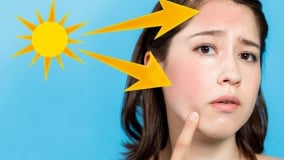 Những cách đơn giản giúp bảo vệ làn da khỏi nắng nóng mùa hè