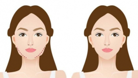 8 mẹo hiệu quả để giảm mỡ mặt