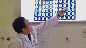 Bệnh viện Đa khoa Cà Mau can thiệp thành công ca phình mạch não