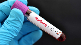 UBND TP.HCM chỉ đạo khẩn, yêu cầu tăng cường giám sát phòng, chống dịch bệnh Marburg